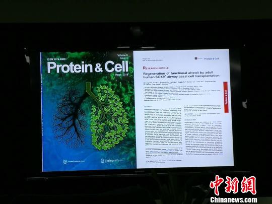 中国学者实现全球首例人类肺脏再生