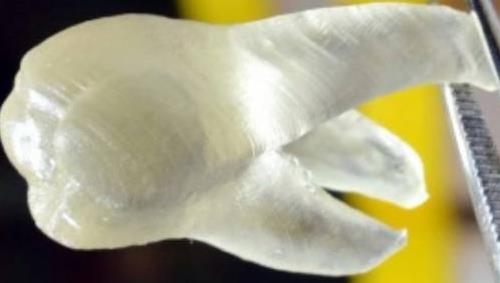 美研究人员开发出抗真菌感染的３Ｄ打印假牙