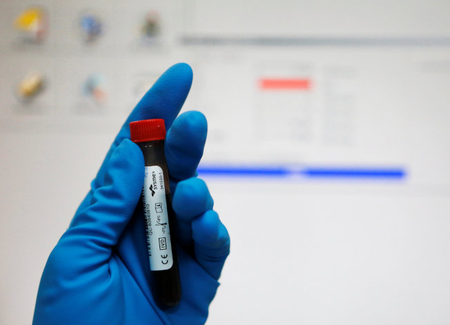耶鲁大学新的验血方法 精准测出你还能活多久