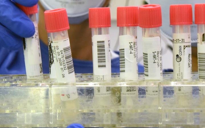 动物活体实验证实 新冠疫苗鼻腔滴入可起到免疫效果